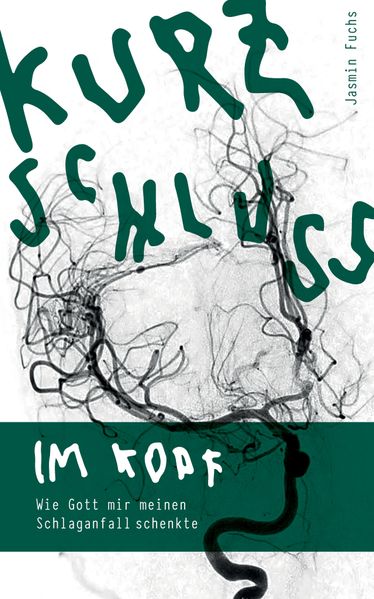 Cover von Kurzschluss im Kopf