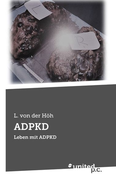 Cover von ADPKD