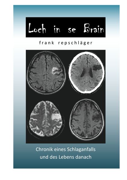 Cover von Loch in se Brain