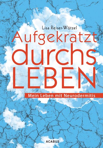 Cover von Aufgekratzt durchs Leben. Mein Leben mit Neurodermitis