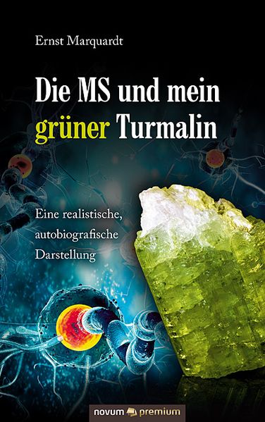 Cover von Die MS und mein grüner Turmalin