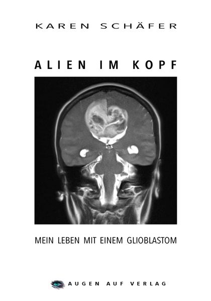 Cover von Alien im Kopf