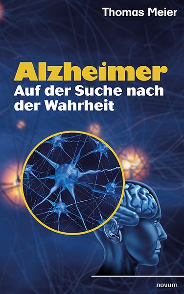 Cover von Alzheimer – Auf der Suche nach der Wahrheit